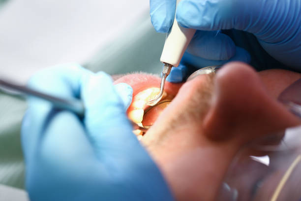Best Emergency Tooth Extraction  in Nutter Fort, WV