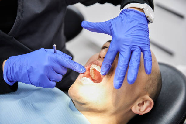 Best Dentist for Tooth Abscess  in Nutter Fort, WV