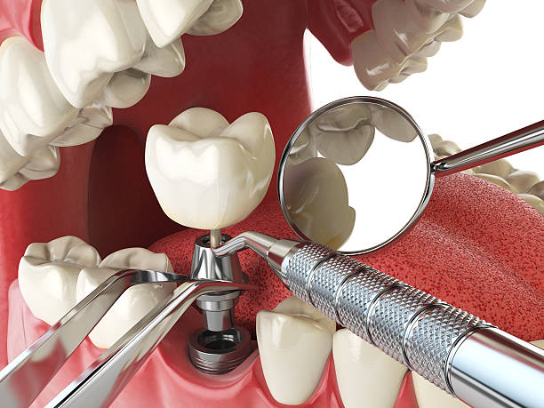 Best Cracked Tooth Emergency Dentist  in Nutter Fort, WV